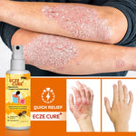 Eczecure+™ Bee Venom Fungal Treatment Spray 🐝✨(Buy 1 Get 1 Free🔥🔥)