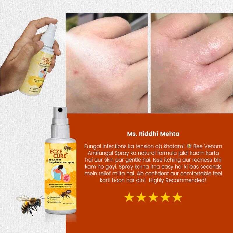 Eczecure+™ Bee Venom Fungal Treatment Spray 🐝✨(Buy 1 Get 1 Free🔥🔥)